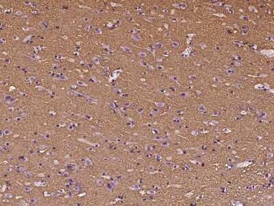 Immunohistochemistry-Paraffin: BASP1 Antibody [NBP2-99048]