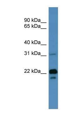 Western Blot: BASP1 Antibody [NBP1-68958]