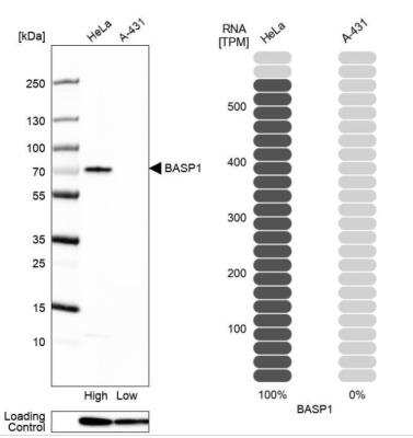 Western Blot: BASP1 Antibody [NBP2-14347]