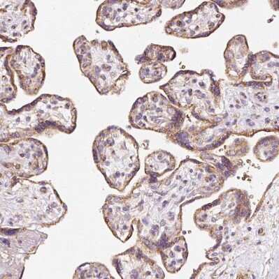 Immunohistochemistry-Paraffin: BAT2 Antibody [NBP2-33471]