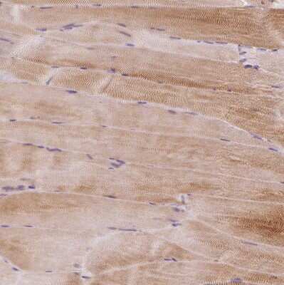 Immunohistochemistry-Paraffin: BAT2 Antibody [NBP2-33471]