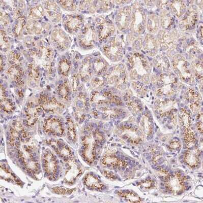 Immunohistochemistry-Paraffin: BAT2 Antibody [NBP2-33471]