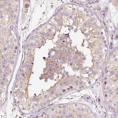 Immunohistochemistry-Paraffin: BAT2 Antibody [NBP2-33471]