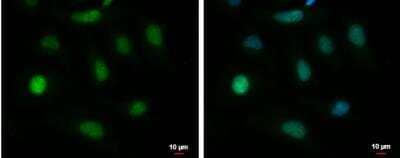 Immunocytochemistry/ Immunofluorescence: BAT3/BAG6 Antibody [NBP2-15547]