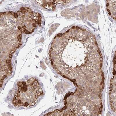 Immunohistochemistry-Paraffin: BAT3/BAG6 Antibody [NBP2-38537]