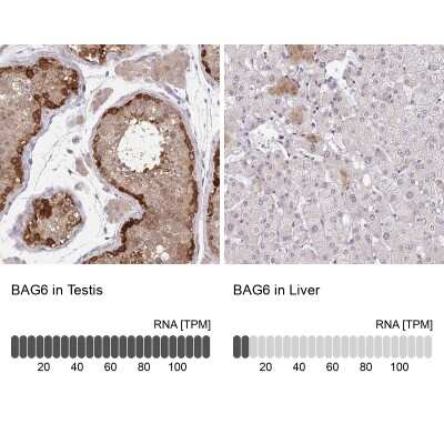 Immunohistochemistry-Paraffin: BAT3/BAG6 Antibody [NBP2-38537]