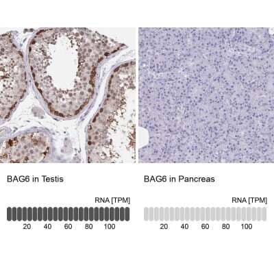 Immunohistochemistry-Paraffin: BAT3/BAG6 Antibody [NBP2-38693]