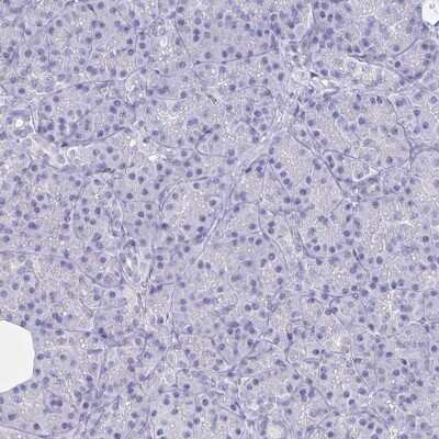 Immunohistochemistry-Paraffin: BAT3/BAG6 Antibody [NBP2-38693]