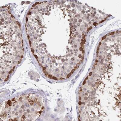 Immunohistochemistry-Paraffin: BAT3/BAG6 Antibody [NBP2-38693]