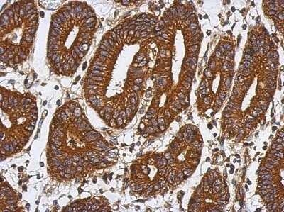 Immunohistochemistry-Paraffin: BAT5 Antibody [NBP2-15548]