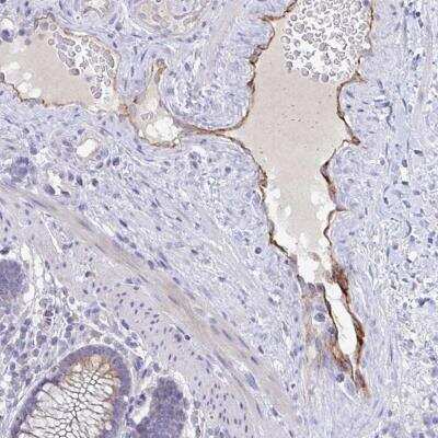 Immunohistochemistry-Paraffin: BAT5 Antibody [NBP2-34116]