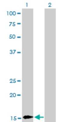Western Blot: BATF Antibody (1G4) [H00010538-M03]