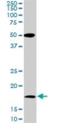 Western Blot: BATF Antibody (8A12) [H00010538-M01]