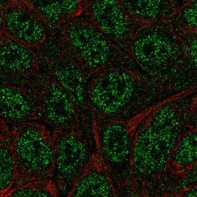 Immunocytochemistry/ Immunofluorescence: BATF Antibody [NBP2-49431]