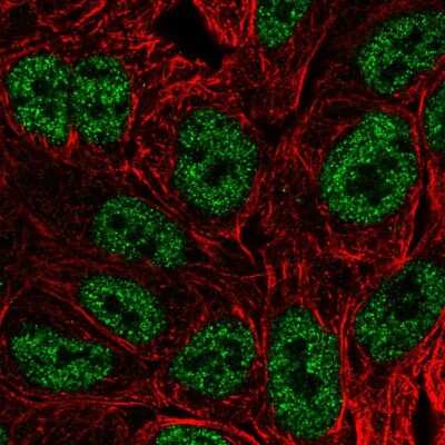 Immunocytochemistry/ Immunofluorescence: BATF Antibody [NBP2-56580]