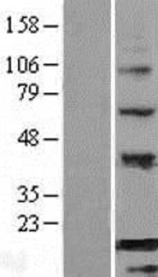 Western Blot: BATF Overexpression Lysate [NBP2-07623]