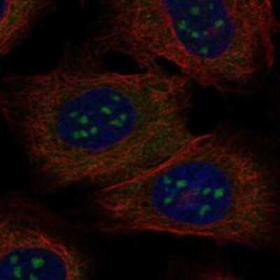 Immunocytochemistry/ Immunofluorescence: BATF3 Antibody [NBP3-17688]