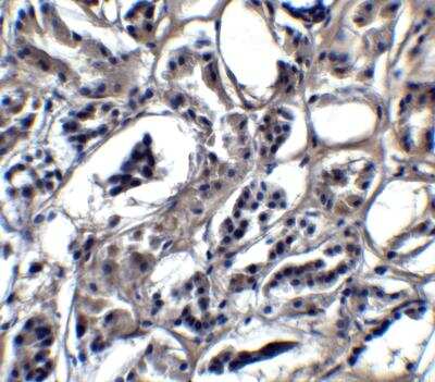Immunohistochemistry: BATF3 Antibody - BSA Free [NBP2-41296]