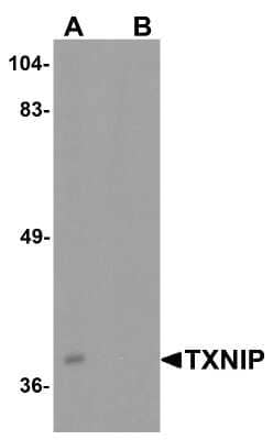 Western Blot: BATF3 AntibodyBSA Free [NBP2-41296]