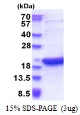 SDS-PAGE: Recombinant Human BATF3 His Protein [NBP2-51579]