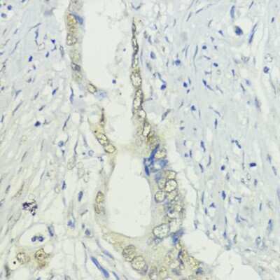 Immunohistochemistry-Paraffin: BAZ2A Antibody - Azide and BSA Free [NBP2-91988]