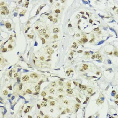 Immunohistochemistry-Paraffin: BAZ2A Antibody - Azide and BSA Free [NBP2-91988]