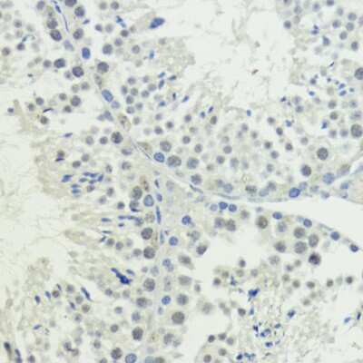 Immunohistochemistry-Paraffin: BAZ2A Antibody - Azide and BSA Free [NBP2-91988]