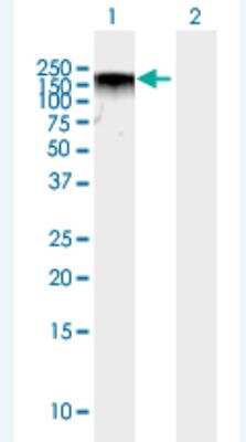 Western Blot: BAZ2A Antibody [H00011176-B01P-50ug]