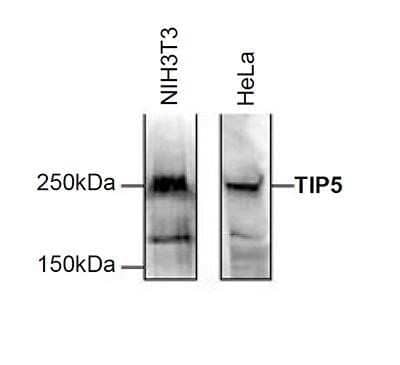 Western Blot: BAZ2A Antibody [NBP2-59158]