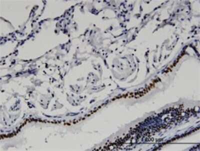 Immunohistochemistry-Paraffin: BAZ2B Antibody (2D10) [H00029994-M07]