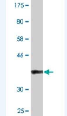 Western Blot: BAZ2B Antibody (2D10) [H00029994-M07]