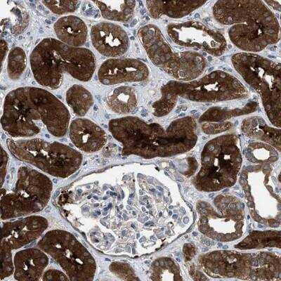Immunohistochemistry-Paraffin: BAZ2B Antibody [NBP1-80622]