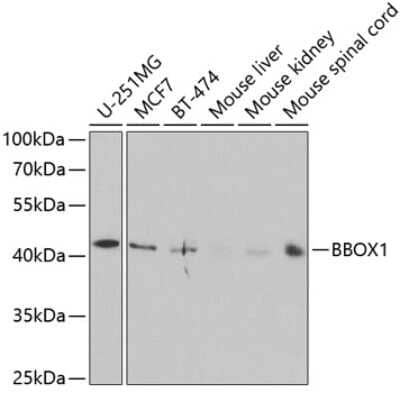 Western Blot: BBOX1 AntibodyBSA Free [NBP2-92462]