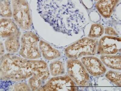 Immunohistochemistry-Paraffin: BBOX1 Antibody (6H3) [H00008424-M01]