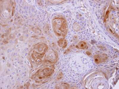 Immunohistochemistry-Paraffin: BBOX1 Antibody [NBP1-32327]