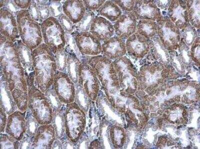 Immunohistochemistry-Paraffin: BBOX1 Antibody [NBP1-32327]