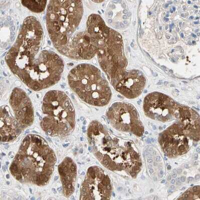 Immunohistochemistry-Paraffin: BBOX1 Antibody [NBP1-88695]