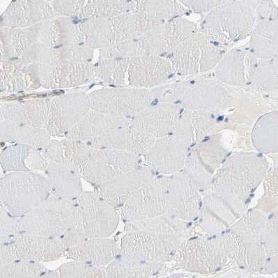Immunohistochemistry-Paraffin: BBOX1 Antibody [NBP1-88695]