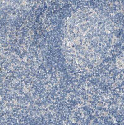 Immunohistochemistry-Paraffin: BBOX1 Antibody [NBP1-88695]