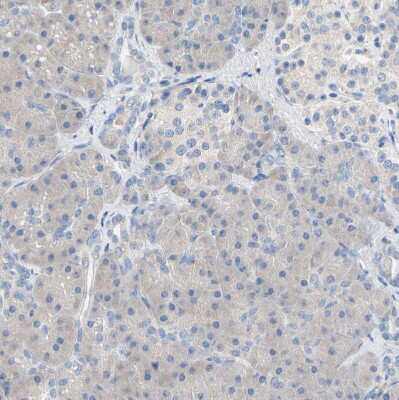 Immunohistochemistry-Paraffin: BBOX1 Antibody [NBP1-88695]