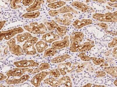 Immunohistochemistry-Paraffin: BBOX1 Antibody [NBP2-97720]