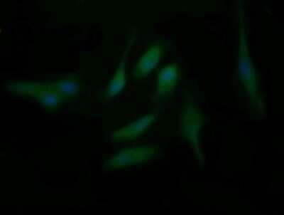 Immunocytochemistry/ Immunofluorescence: BBOX1 Antibody (OTI4F9) - Azide and BSA Free [NBP2-71372]