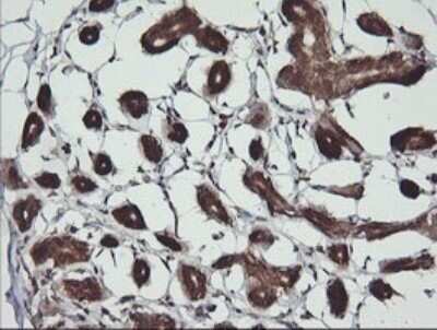 Immunohistochemistry: BBOX1 Antibody (OTI4F9) - Azide and BSA Free [NBP2-71372]