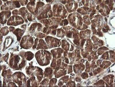 Immunohistochemistry: BBOX1 Antibody (OTI4F9) - Azide and BSA Free [NBP2-71372]
