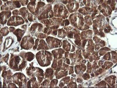 Immunohistochemistry: BBOX1 Antibody (OTI4F9) [NBP2-45548]