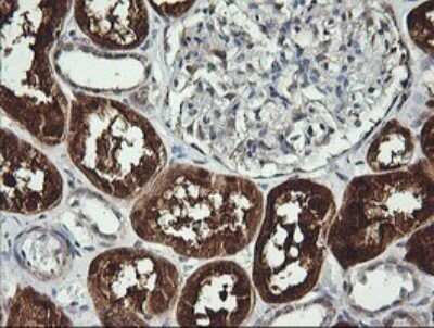 Immunohistochemistry: BBOX1 Antibody (OTI4F9) [NBP2-45548]