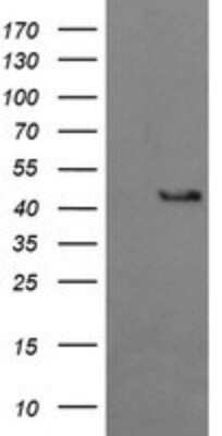 Western Blot: BBOX1 Antibody (OTI4F9) [NBP2-45548]