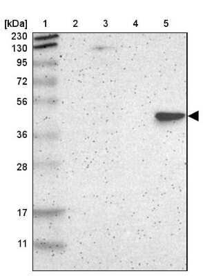 Western Blot: BBOX1 Antibody [NBP1-88695]