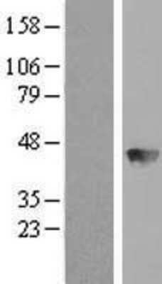 Western Blot: BBOX1 Overexpression Lysate [NBL1-07926]