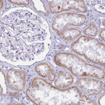 Immunohistochemistry-Paraffin: BBS1 Antibody [NBP2-34106]